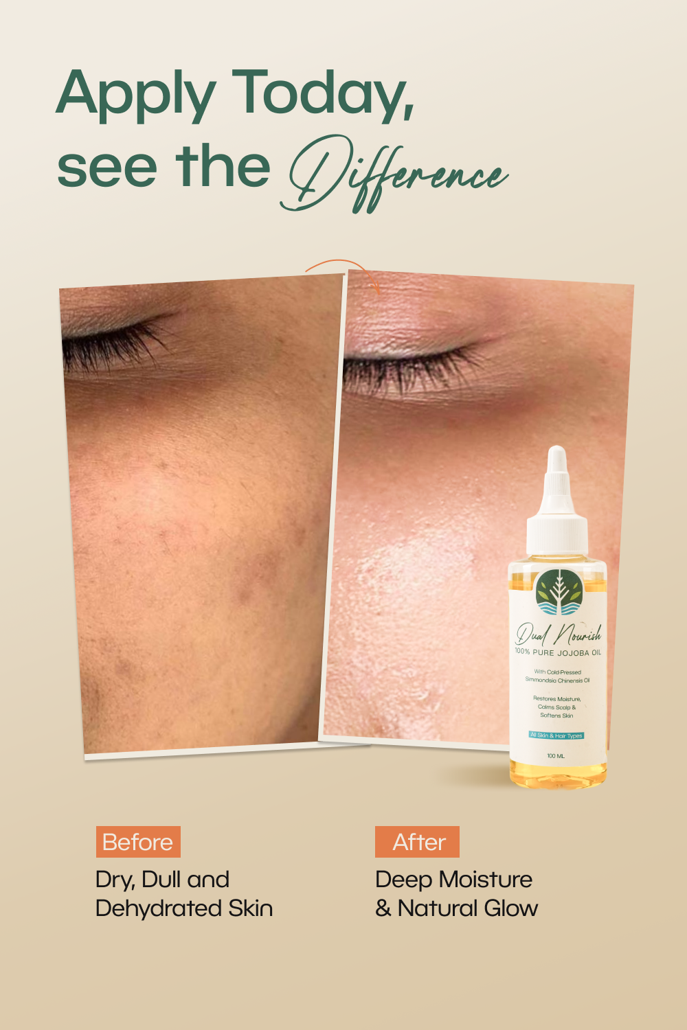 Dual Nourish 100% Pure Jojoba Oil (100 ml)