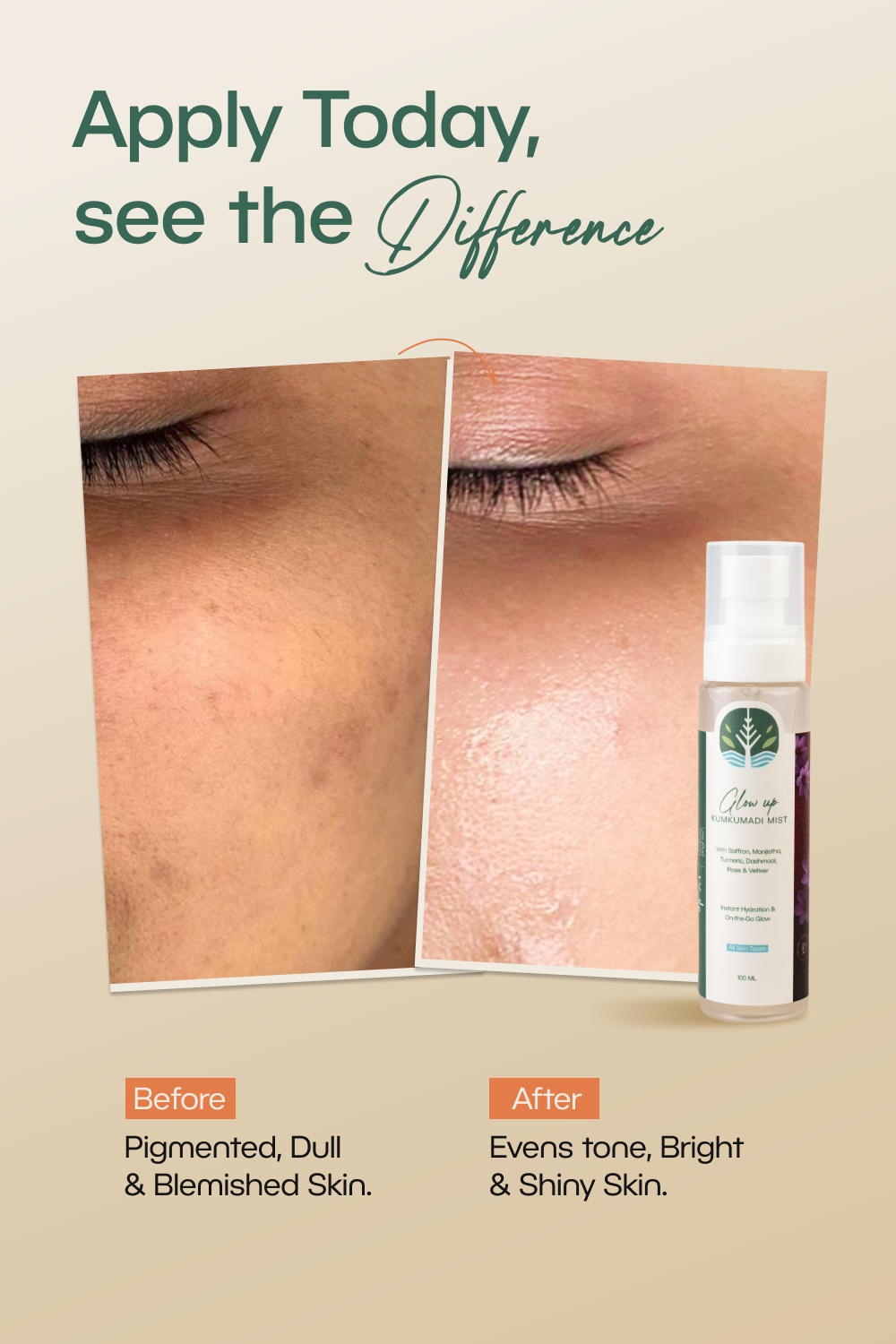 Glow Up Kumkumadi Mist (100 ml)