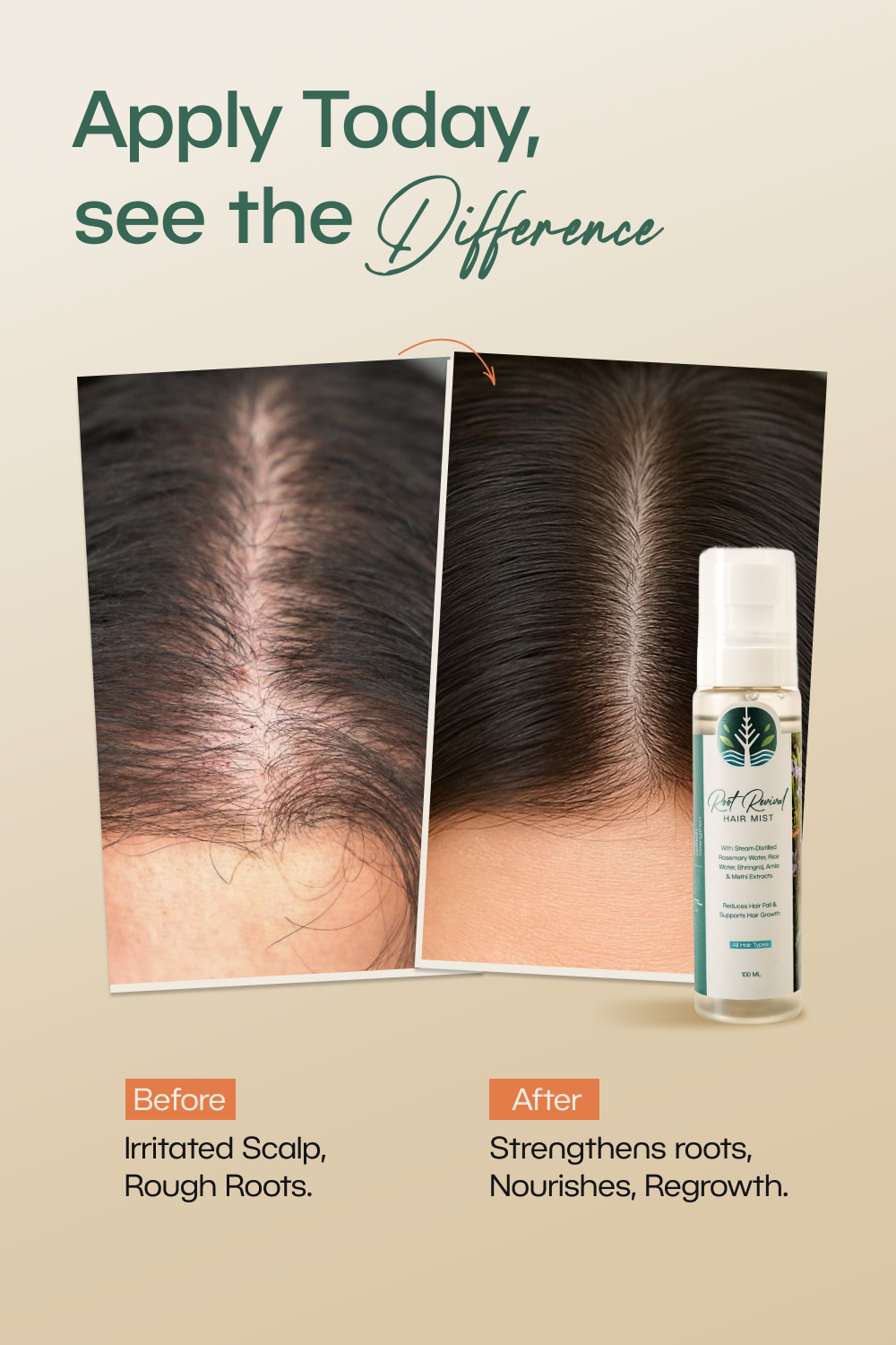 Hair growth mist with rosemary and amla extracts by Sarva for thicker, stronger hair; natural hair growth serum for scalp health, hair regrowth, and anti-hair fall treatment. low porosity